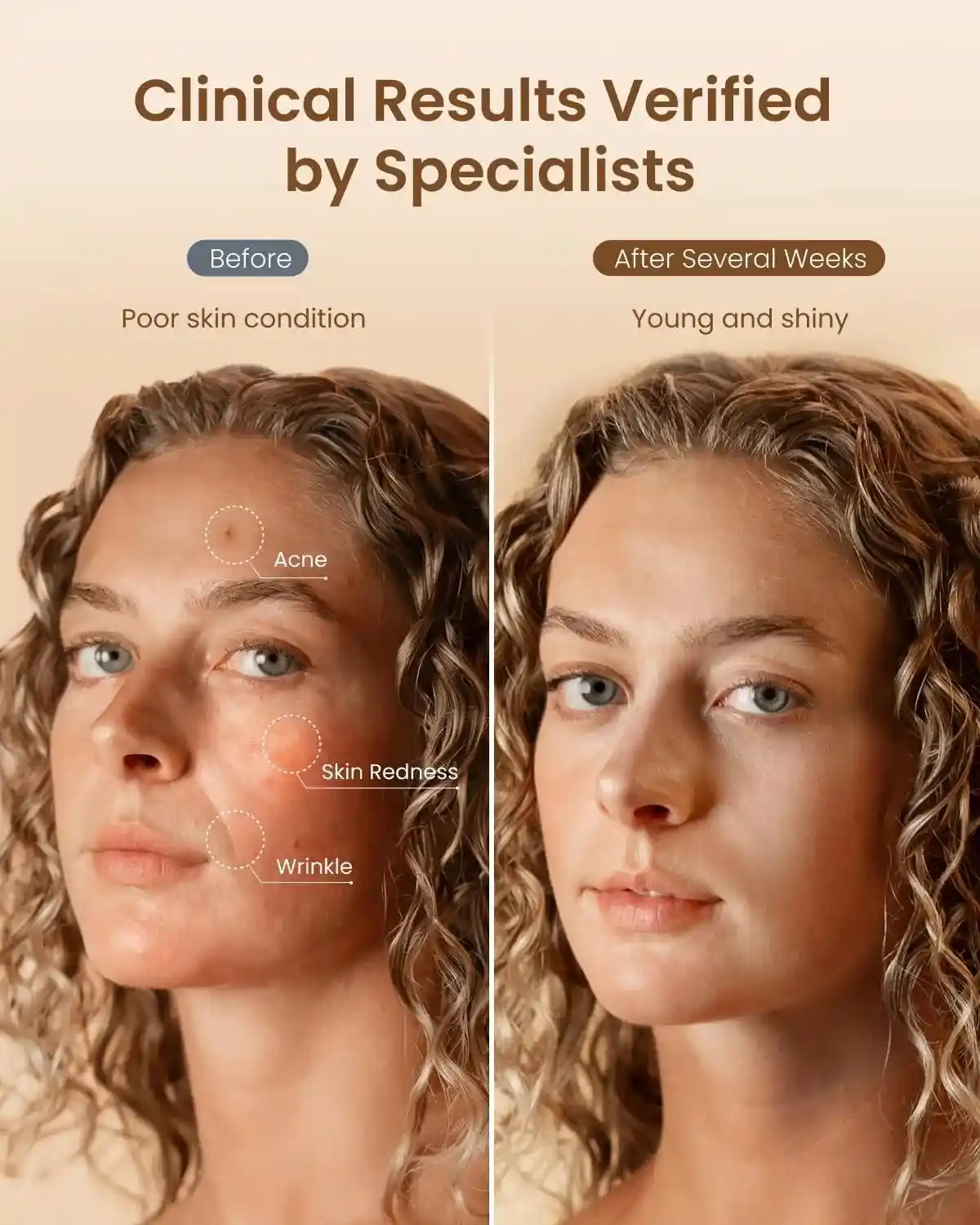 Best Red Light Therapy Mask for Wrinkles Review: RENPHO Face Mask Test 2 best red light therapy mask for wrinkles used at home