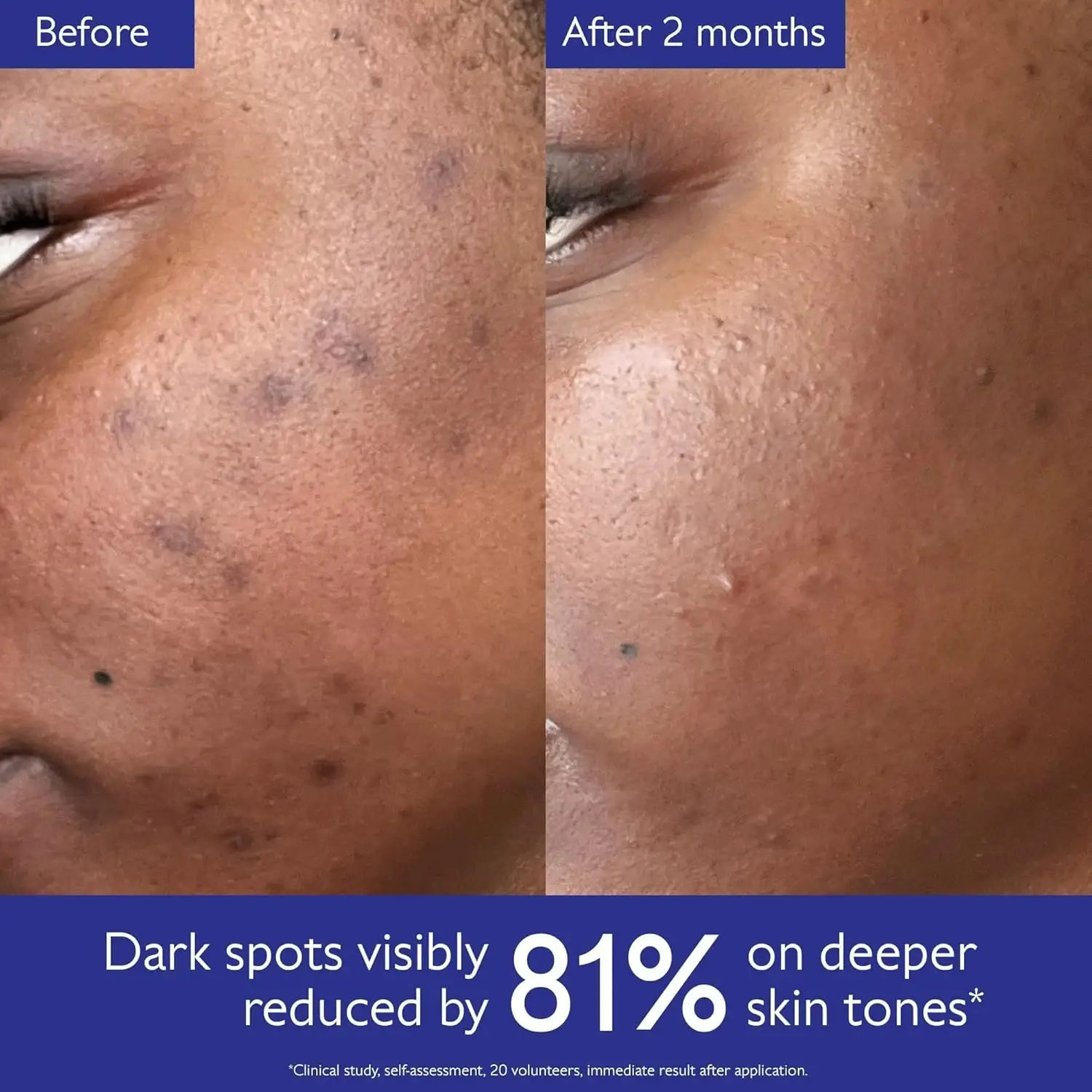 skincare routine with serum and eye creams for dark circles